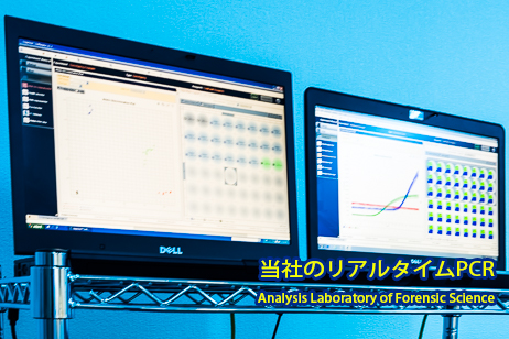 新型コロナウイルス(COVID-19)抗体検査キットの仕組み